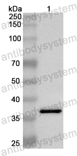 Валидация AntibodySystem PHB29101