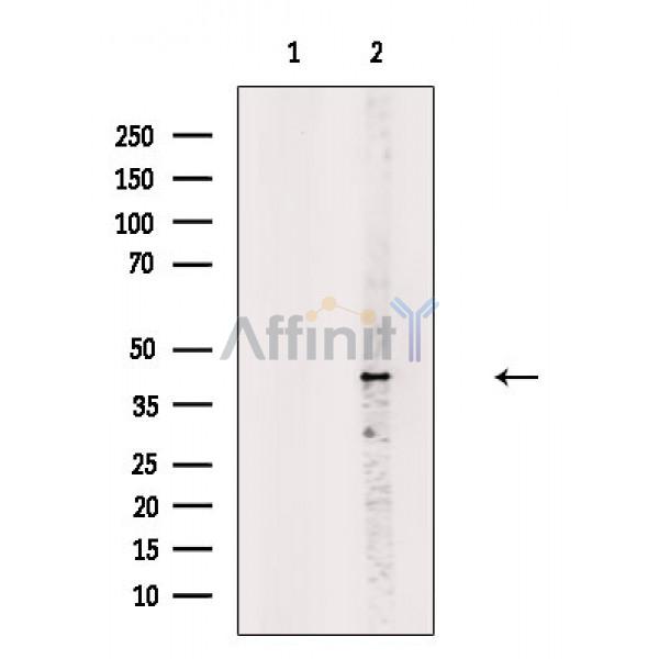 Валидация Affinity DF5207 - 17200