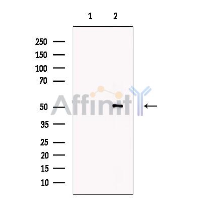 Валидация Affinity DF13213 - 8225