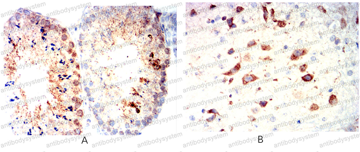 Валидация AntibodySystem RHE35402 (2108)