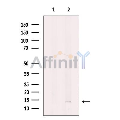 Валидация Affinity DF12384 - 6854