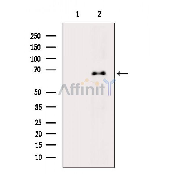 Валидация Affinity DF7468 - 19226