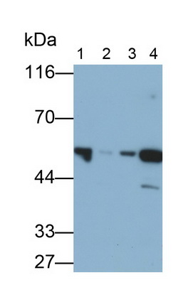 65213