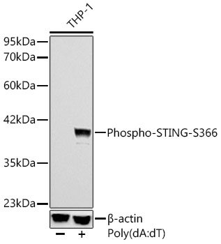 AP1369, вестерн-блоттинг, лизат клеток THP-1 (18652)