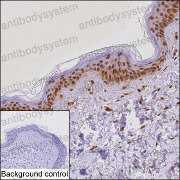 Валидация AntibodySystem RHD71701