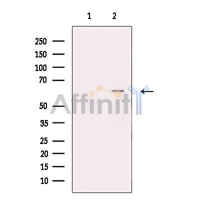 Валидация Affinity DF13434 - 8751
