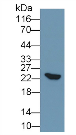 57095