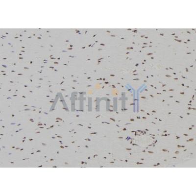 Валидация Affinity DF7191 - 18854
