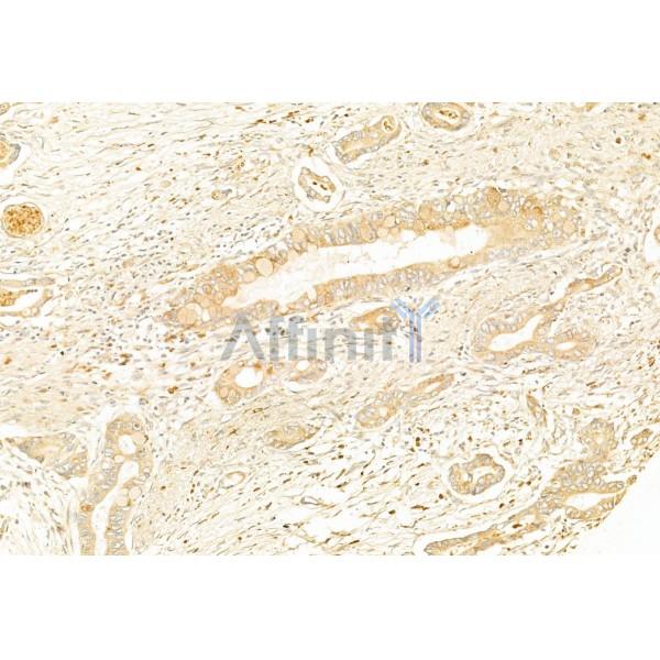 Валидация Affinity DF6251 - 17540