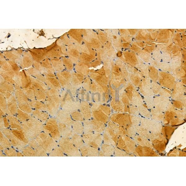 Валидация Affinity DF12058 - 6116