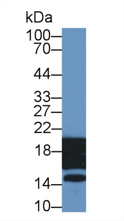 17585