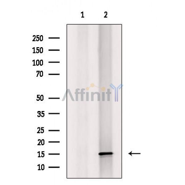 Валидация Affinity DF3647 - 14631