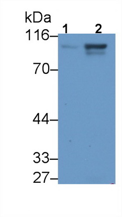 65076