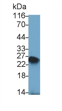 49126