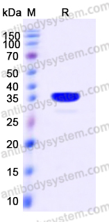 YHD82803, SDS-PAGE