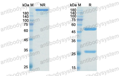Валидация SDS-PAGE - AntibodySystem DHJ92102
