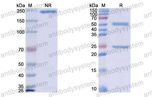 Валидация SDS-PAGE - AntibodySystem RMB96702