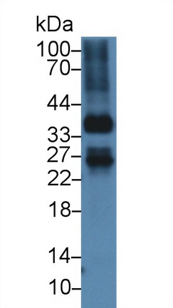 13914