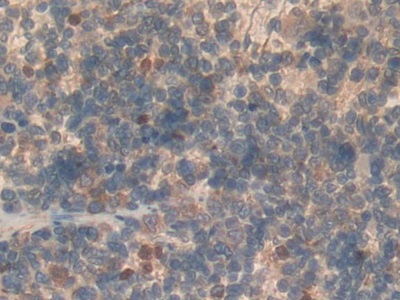 15939