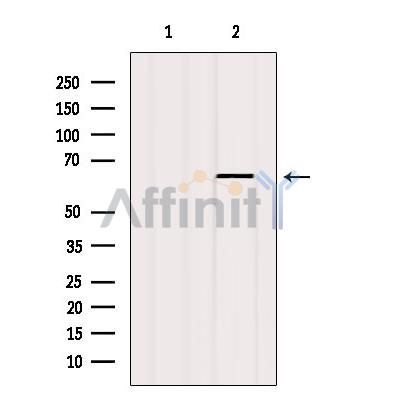 Валидация Affinity AF6058 - 3260