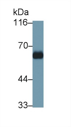 55522