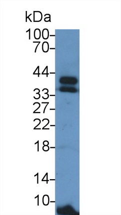 15256