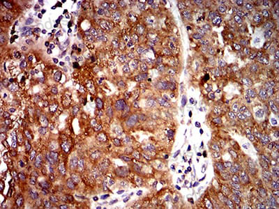 Валидация AntibodySystem RHK46903 (3678)