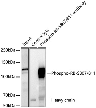 AP1541, иммунопреципитация, экстракт клеток MCF7 (27942)