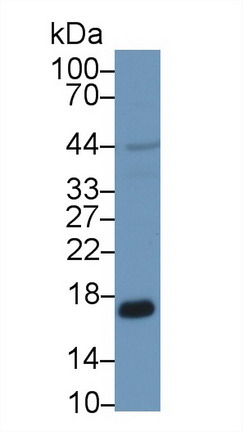 9585