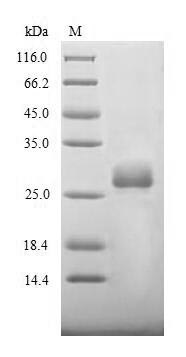SDS-PAGE