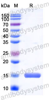 Валидация SDS-PAGE - AntibodySystem RHC01404