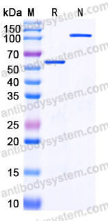 EHE01903, SDS-PAGE