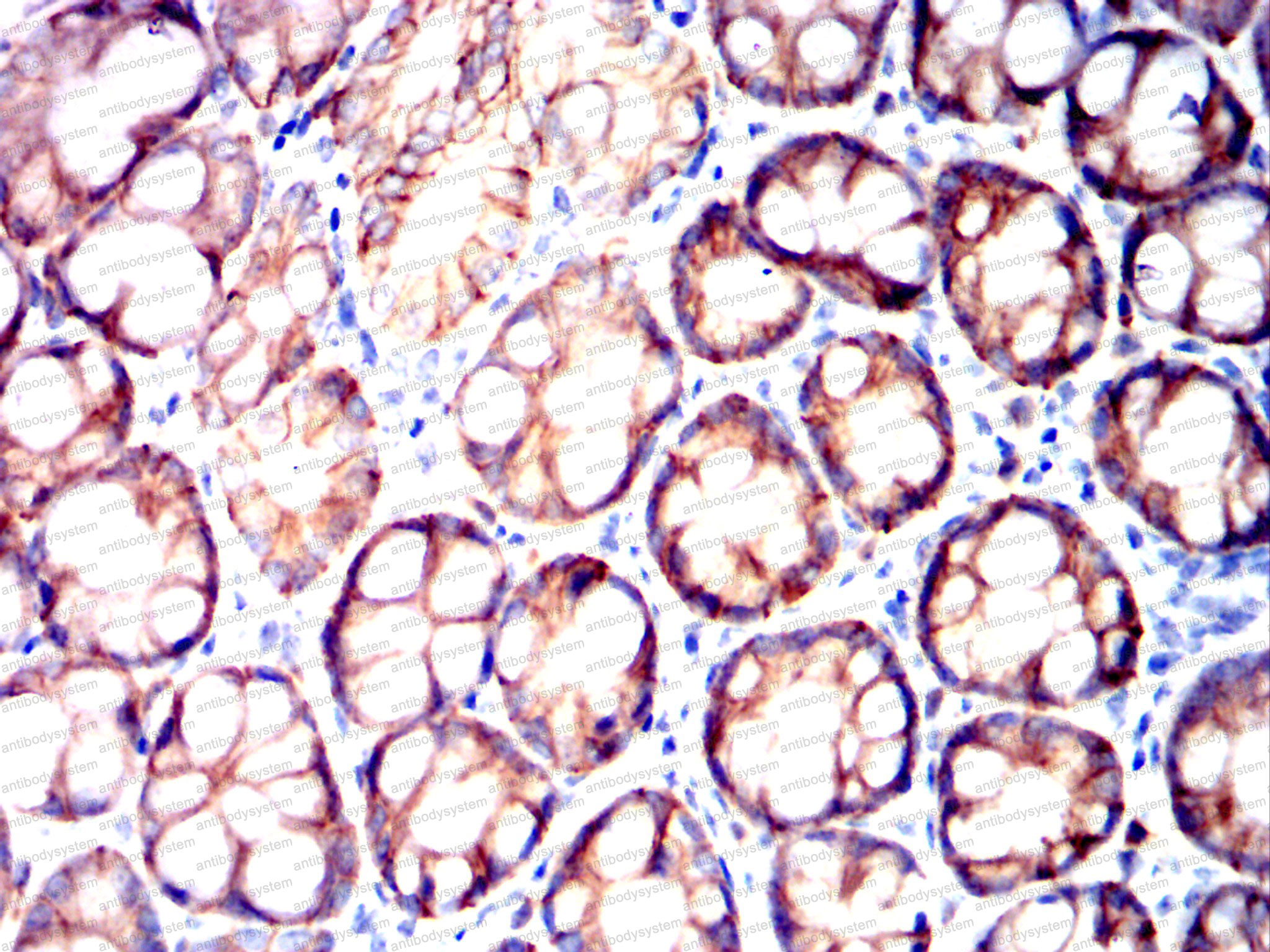 Валидация AntibodySystem RHD17405 (1388)
