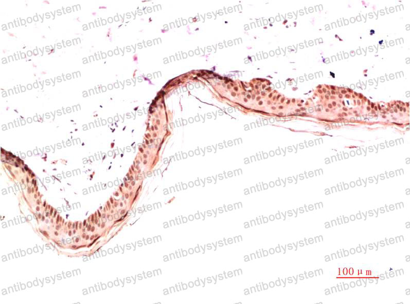 Валидация AntibodySystem RHB97406
