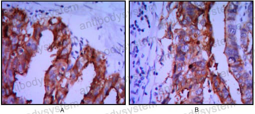 Валидация AntibodySystem RHC15404