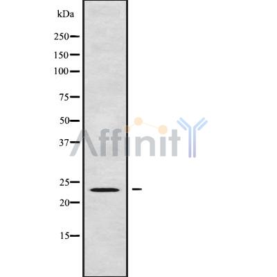Валидация Affinity DF10000 - 5436