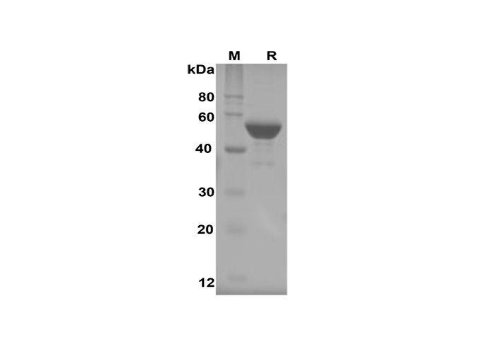 PDMM100249, электрофорез в ПААГ с ДСН