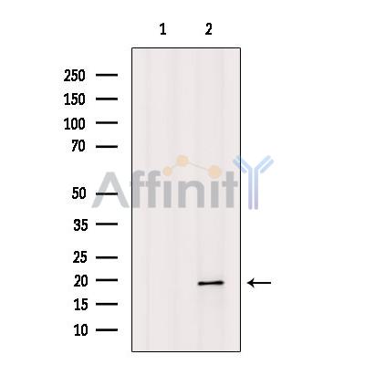 Валидация Affinity AF6232 - 3468