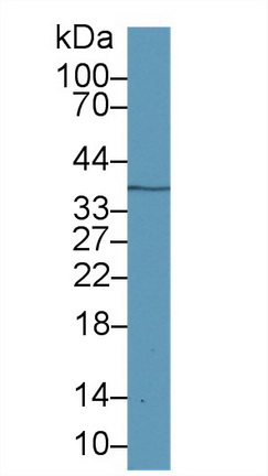 14525