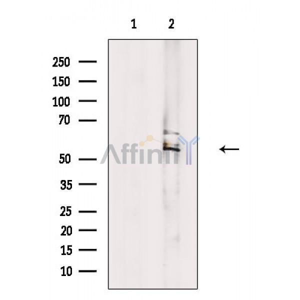 Валидация Affinity DF10134 - 5651