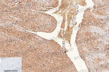 Валидация AntibodySystem RHC18706 (733)