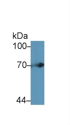 13869