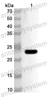 Валидация AntibodySystem PHB00701