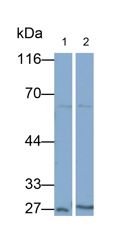 31000