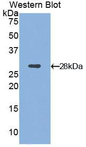 57162