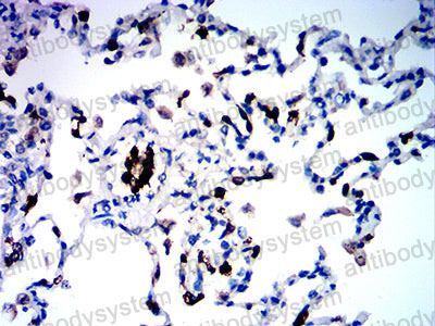 Валидация AntibodySystem RHH08901 (3165)