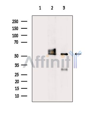 Валидация Affinity AF9167 - 4977
