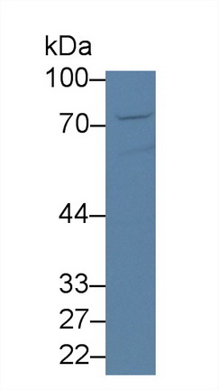 13966
