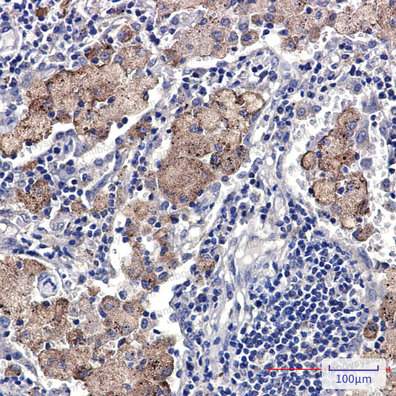 Валидация AntibodySystem RHH32804