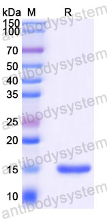 Валидация SDS-PAGE - AntibodySystem RHD62601